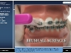 OrthoAssist Referral #4
